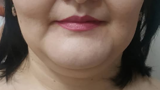 До — двойной подбородок