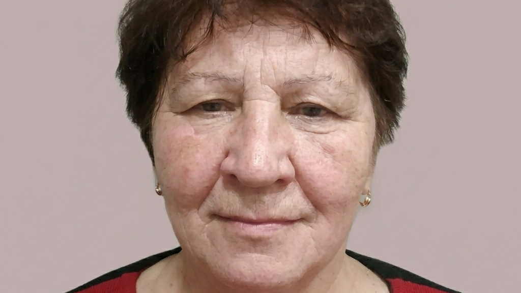 До — омоложение лица